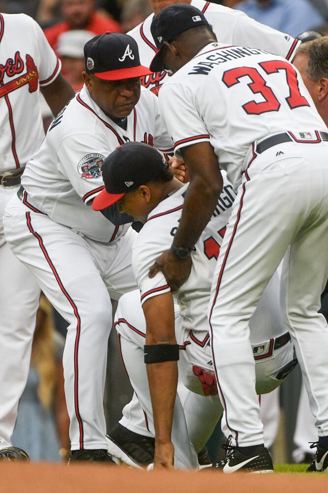 Photos: Braves’ Camargo suffers freak injury