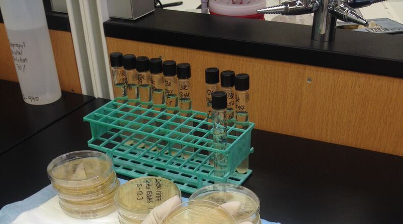 The Centers for Disease Control and Prevention gets involved when an outbreak crosses state lines or is particularly complicated. This shows a test for salmonella. CONTRIBUTED BY CDC