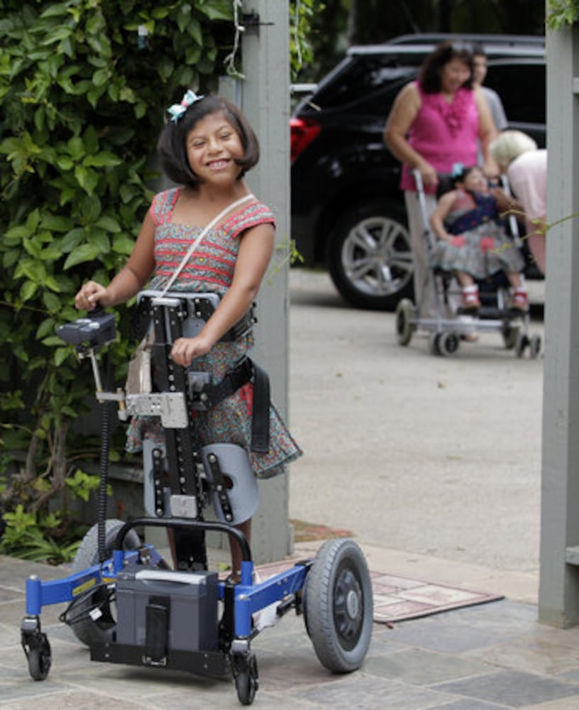 Guatemalan twins, formerly conjoined, turn 10