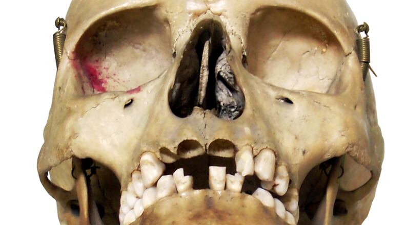 This skull is not one of the three donated.