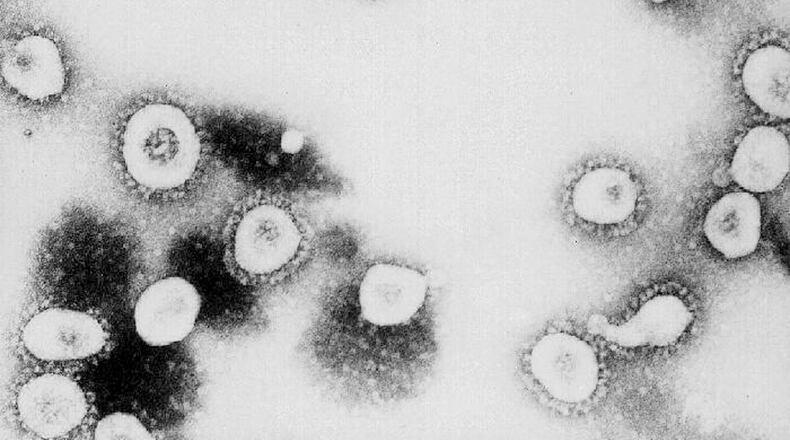ATLANTA, GA - UNDATED: This undated handout photo from the Centers for Disease Control and Prevention (CDC) shows a microscopic view of the Coronavirus at the CDC in Atlanta, Georgia. According to the CDC the virus that causes Severe Acute Respiratory Syndrome (SARS) might be a "previously unrecognized virus from the Coronavirus family." (Photo by CDC/Getty Images)