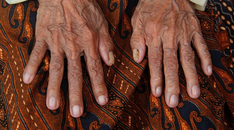PURWAKARTA, INDONESIA - MAY 15: Anami shows her wrinkled fingers May 15, 2015 in Purwakarta, Indonesia. According to members of her family, Anami is believed to be 140 years old and is set to be put through a thorough medical examination as part of the World's Oldest Woman contest in Russia. Anami has had to meet with the District Head of Purwakarta to request his support to attend the competition in which the winner will receive Rp 13 billion. The world's current oldest known living person is 115-year-old Jeralean Talley of the U.S. (Photo by Nurcholis Anhari Lubis/Getty Images)