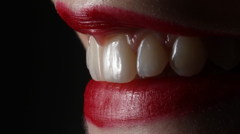 The FDA has issued updated regulations on mercury-containing dental fillings.