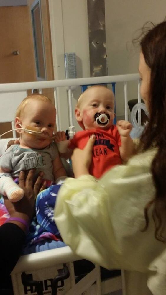 Formerly conjoined twins Carter and Conner