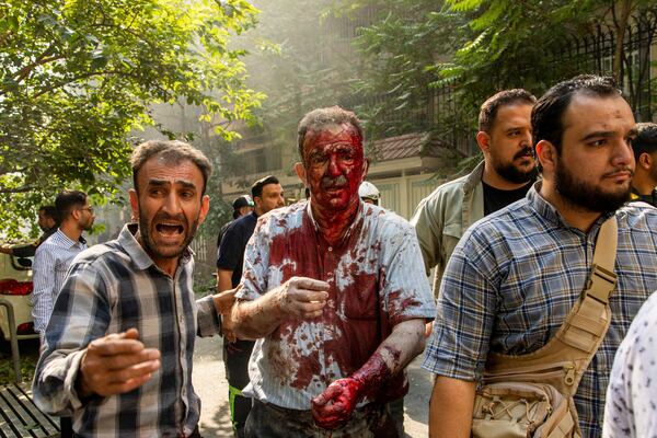 An injured man is helped to leave the scene after an explosion in downtown Tehran, amid Israel's two-day campaign of strikes against Iran, Sunday, June 15, 2025. (AP Photo/Morteza Zangene/ISNA)