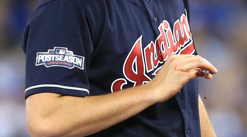 Maybe it wasn't the best idea for the Indians to trot out pitcher Trevor Bauer and his injured finger for Game Three of the ALCS. (Vaughn Ridley/Getty Images)
