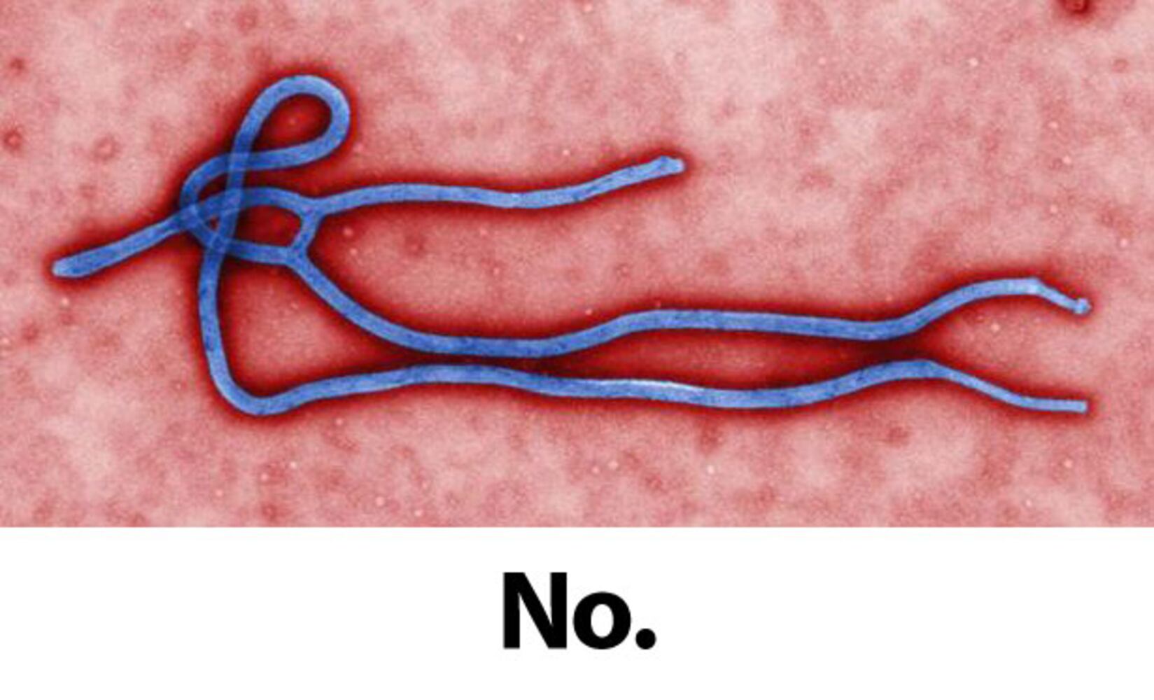 Ebola virus Q & A