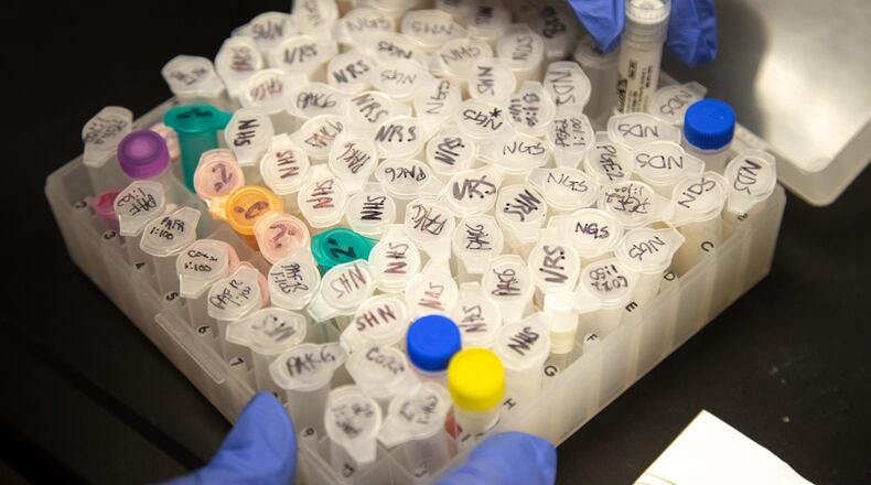 University-led research can lead to lifesaving treatments. Here, a student handles samples for bladder cancer research. (AJC 2020)