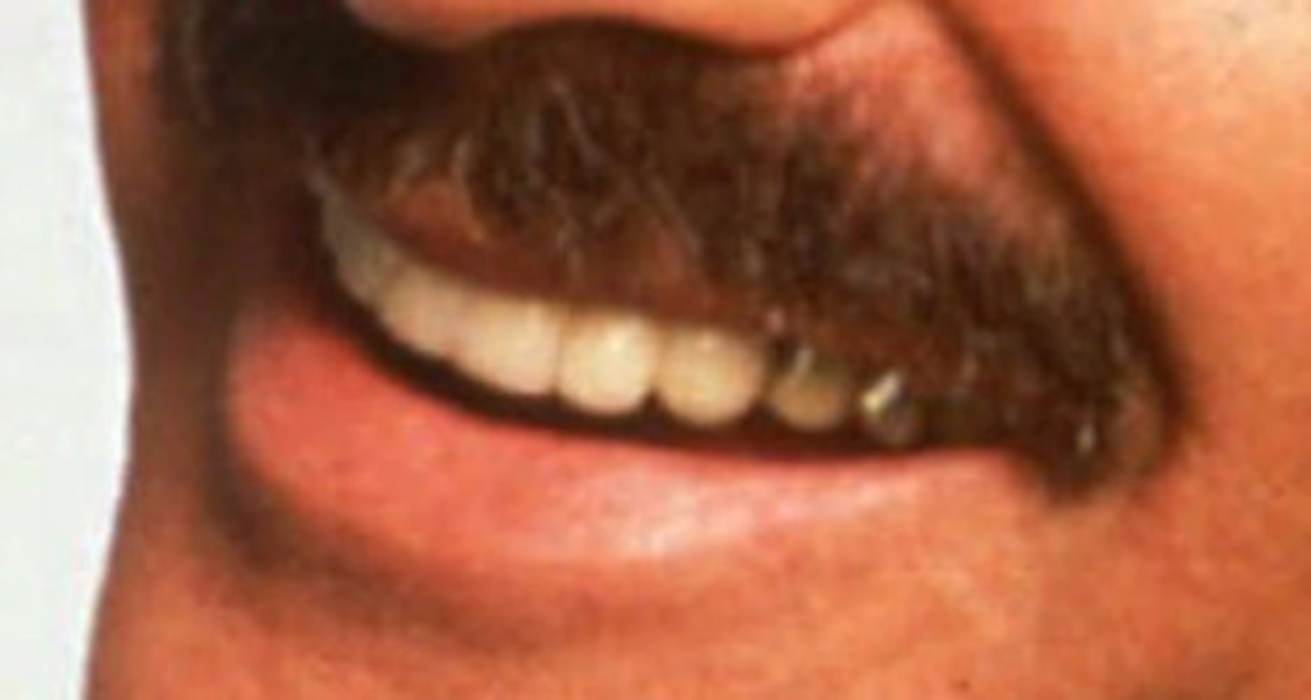 Whose celebrity mustaches are these?