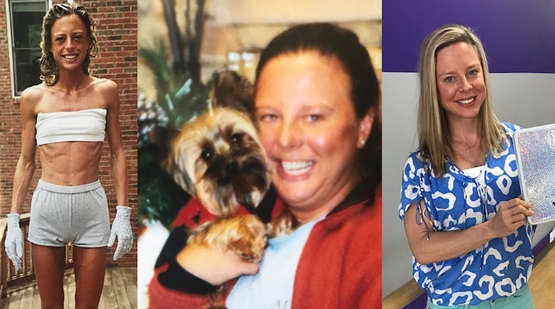 In the photo on the left, taken in 1999 when she was age 19, Kim Schaper weighed 75 pounds. In the center photo, taken two years, Schaper weighed 185 pounds. In the photo on the right, taken in November, Schaper weighed 135 pounds. She calls it her “healthy weight.”