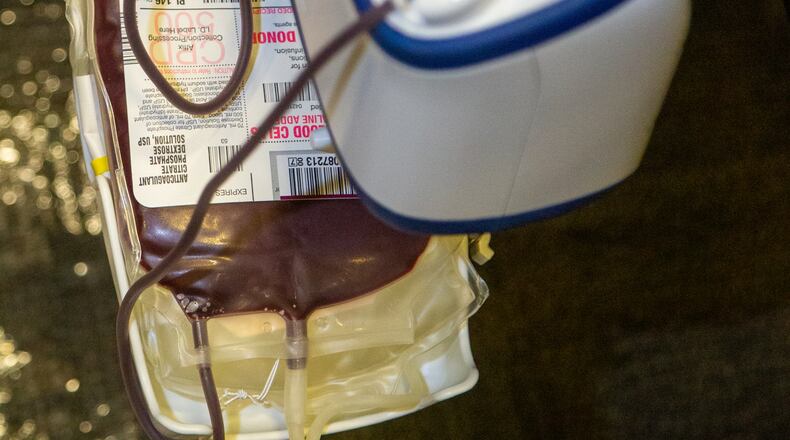 A DeKalb County blood drive to be held on Wednesday, Sept. 29 focuses on fighting sickle cell disease with a diverse blood supply. AJC file photo