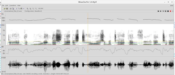 This graph shows the tonal frequencies produced by Jamie Dupree’s voice pronouncing a few words. The sounds were harvested from an audiotape of a radio broadcast by Dupree. The statistical analysis of his voice was completed by Scotland-based company CereProc, which used that information to create a synthetic voice for Dupree. CONTRIBUTED BY CEREPROC