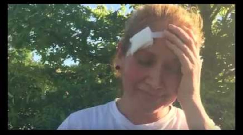 This woman was shot by a pellet gun after leaving Bible study in Sandy Springs.