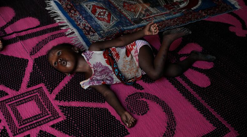 Farisa, who has relapsed into malnutrition, plays on a mat inside her house in Kware Sokoto, northwestern Nigeria, Wednesday, July 15, 2026. (AP Photo/Sunday Alamba)