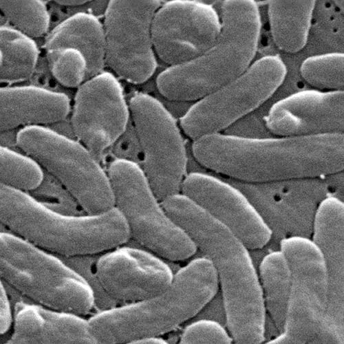 FILE - This 2005 electron microscope image provided by the Centers for Disease Control and Prevention shows Vibrio vulnificus bacteria. (Janice Haney Carr/Centers for Disease Control and Prevention via AP, File)