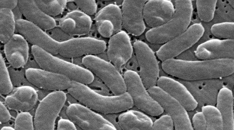 FILE - This 2005 electron microscope image provided by the Centers for Disease Control and Prevention shows Vibrio vulnificus bacteria. (Janice Haney Carr/Centers for Disease Control and Prevention via AP, File)