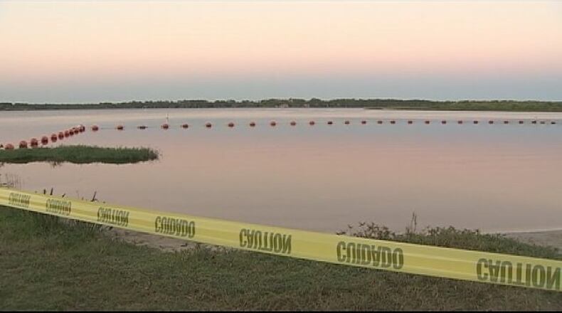 A 10-year-old girl received non-life threatening injuries after an alligator bit her Saturday. (Photo: WFTV)