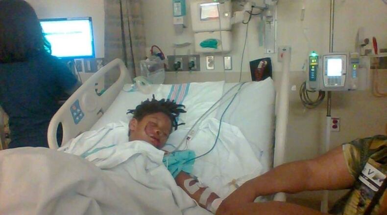 A 6-year-old boy is recovering at Dayton Children’s Hospital after being attacked by a dog in Springfield. (Photo: Springfield News-Sun)