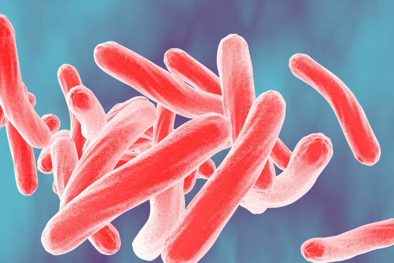 Understanding sickle cell disease