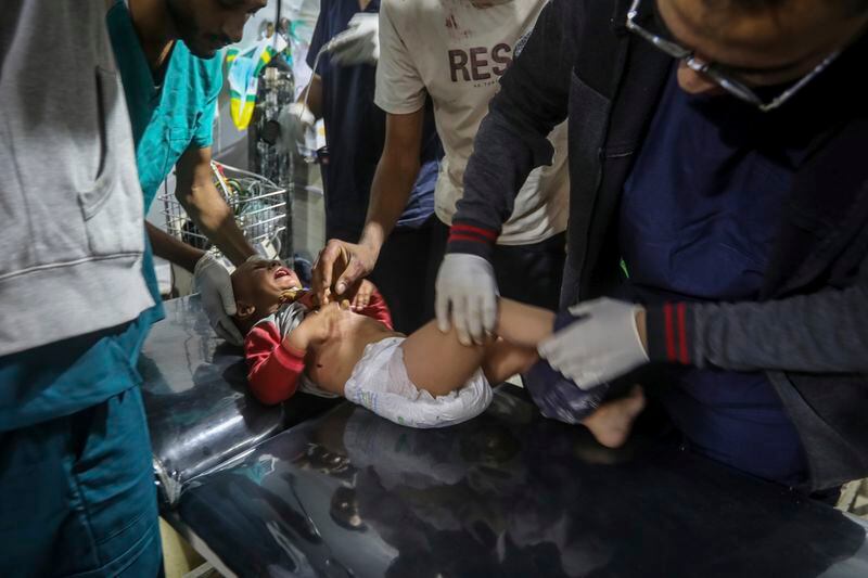 A Palestinian child wounded in the Israeli bombardment of the Gaza Strip is brought to a hospital in Rafah, Gaza, Friday, May 10, 2024. (AP Photo/Ismael Abu Dayyah)