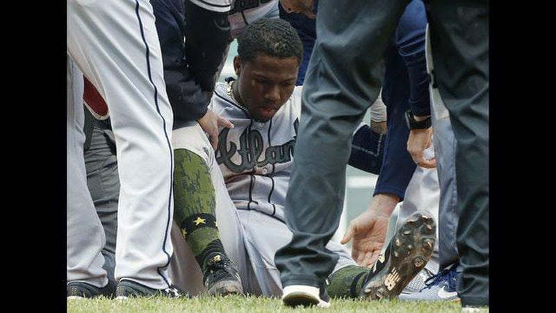 Ronald Acuna hasn’t resumed baseball activities since injuring a knee and his lower back in a fall during a May 27 game at Boston. (AP Photo/Michael Dwyer)