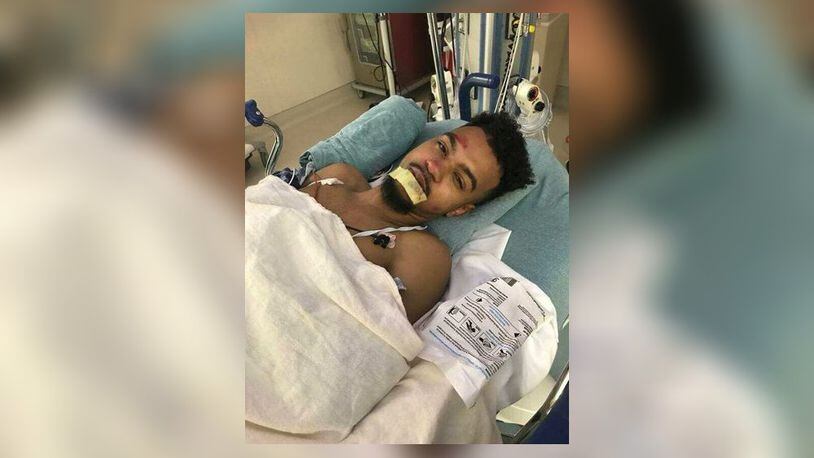 This man was injured Sunday night in Atlanta while he was an Uber passenger.