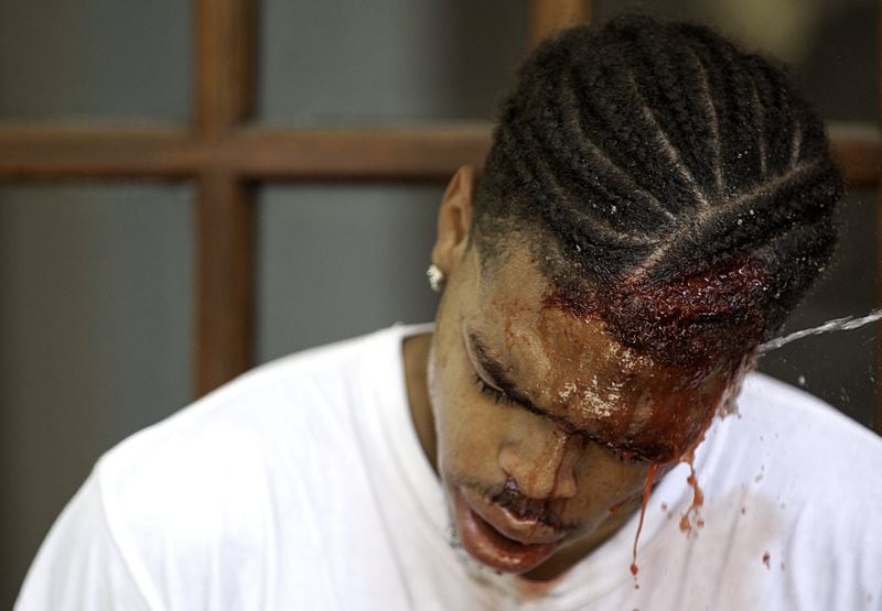 DeAndre Harris after he was beaten by white nationalists in Charlottesville, Va. IAN FRANK/ www.thirdeyejourney.org